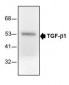 Anti-TGF-b1 Antibody (3D9)